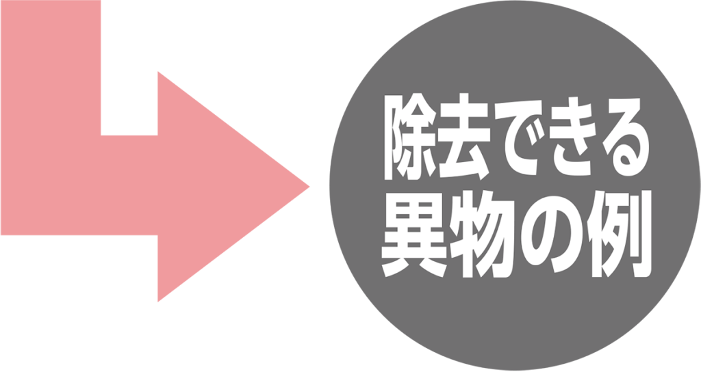 除去できる異物の例