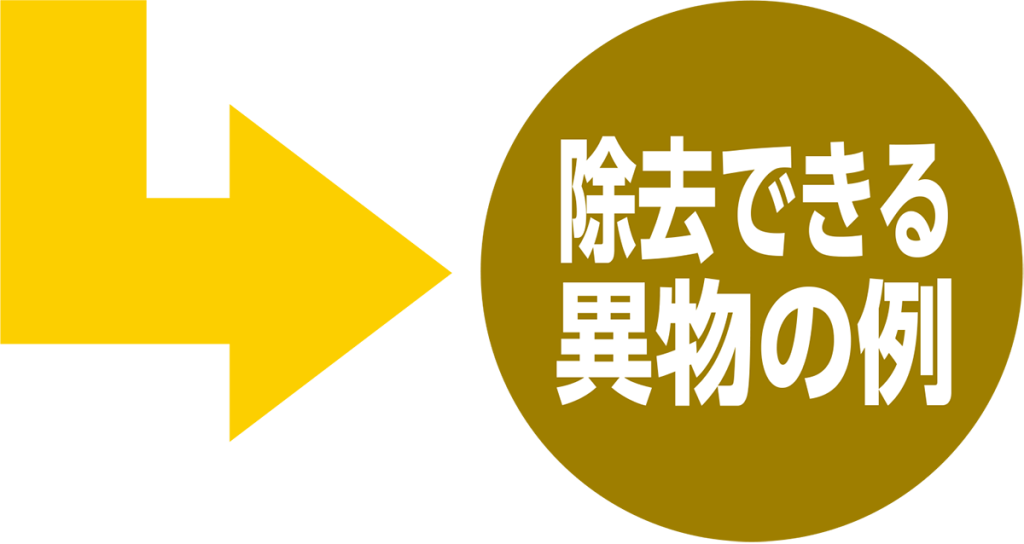 除去できる異物の例